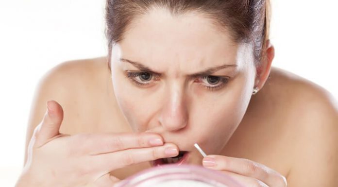 Wat is hirsutisme? hirsutisme